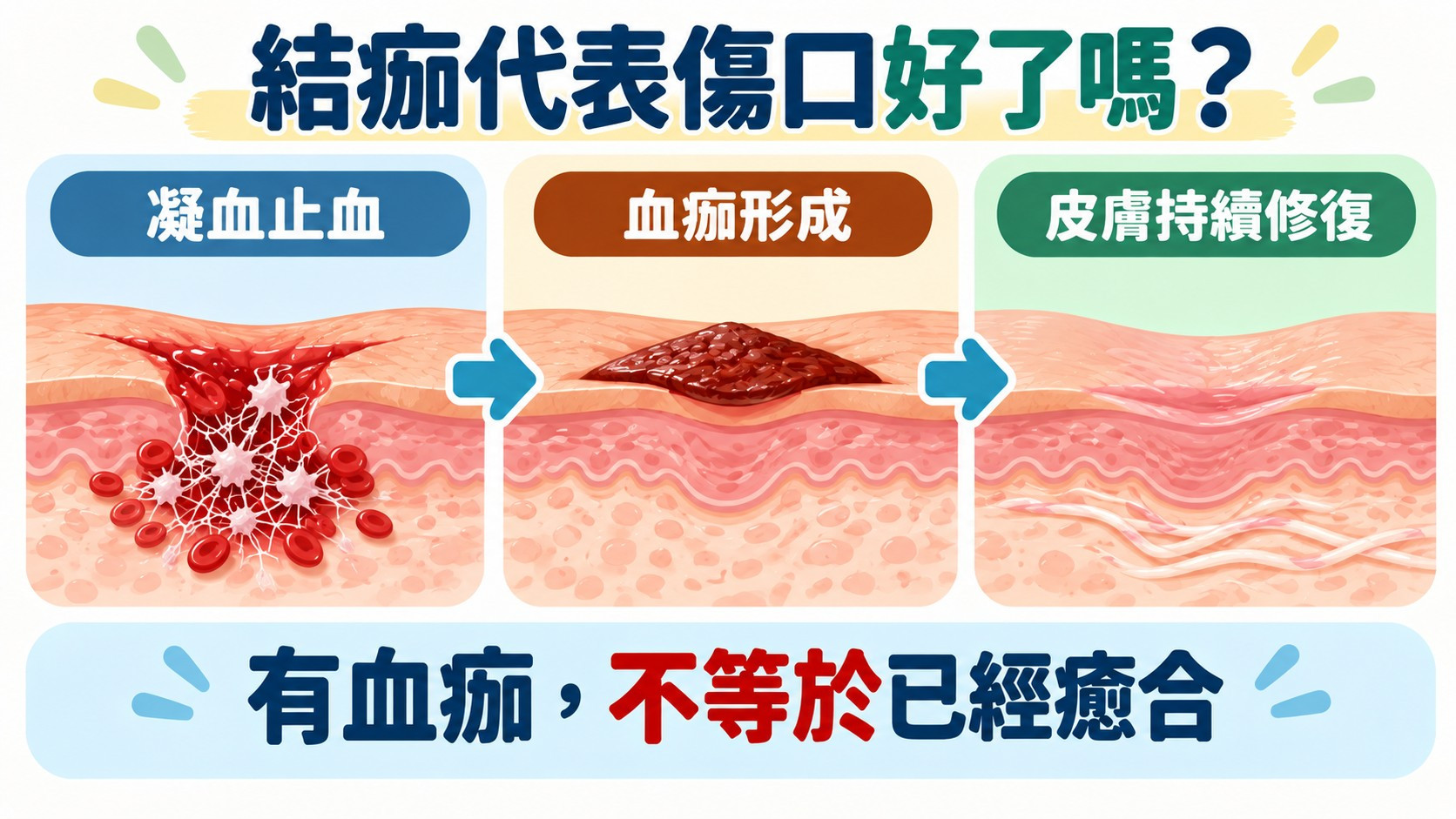 知識卡：結痂代表傷口好了嗎？凝血止血、血痂形成、皮膚持續修復三個階段，有血痂不等於已經癒合